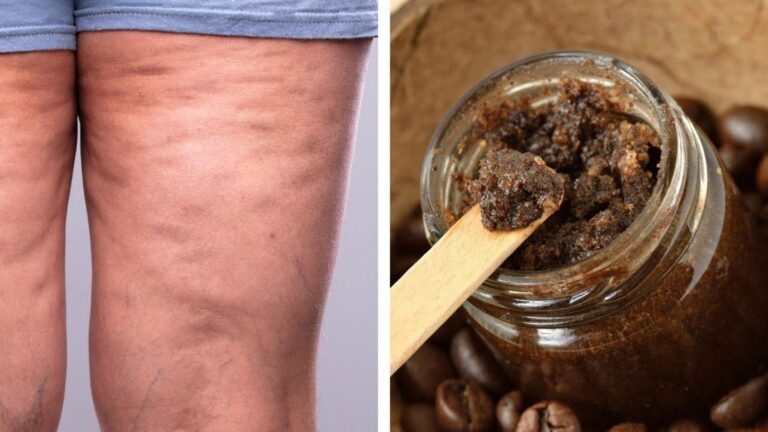 Une astuce café maison pour transformer votre peau et dire adieu à la cellulite…