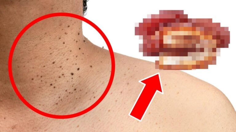 Ce simple ajustement alimentaire… une peau plus lisse, adieu les porris gênants !