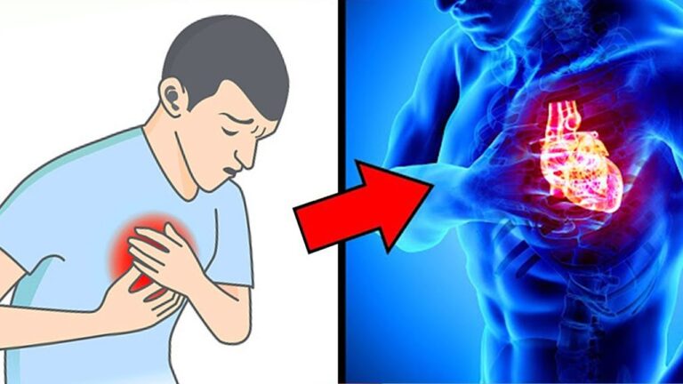 8 signaux surprenants 1 mois avant un infarctus à ne pas ignorer !