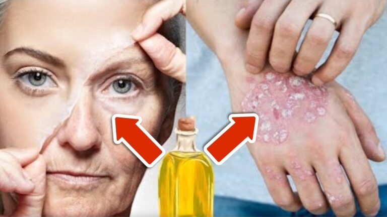 Révélez 5 astuces : cet huile miracle pour effacer rides et psoriasis !