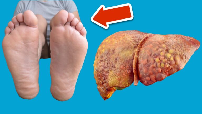5 Signes Surprenants d&rsquo;une Maladie du Foie à Surveiller sur la Peau et les Pieds