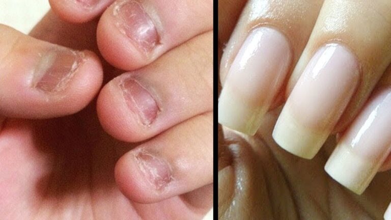 Obtiens de belles ongles longs en 7 jours avec ces astuces simples et efficaces !