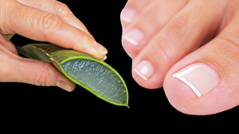 Transformez vos ongles en 5 étapes avec l&rsquo;aloe vera : adieu mycose ! 🌿✨