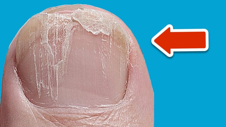 5 Secrets révélés par vos ongles sur votre santé ! Découvrez-les maintenant !