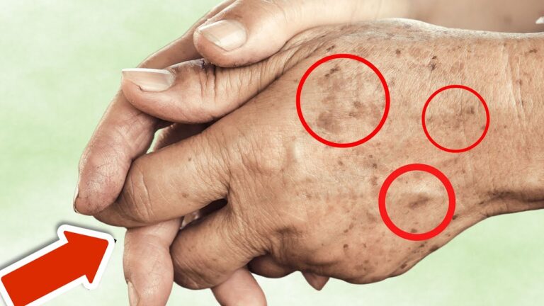 7 aliments secrets pour dire adieu aux taches de vieillesse en une nuit !