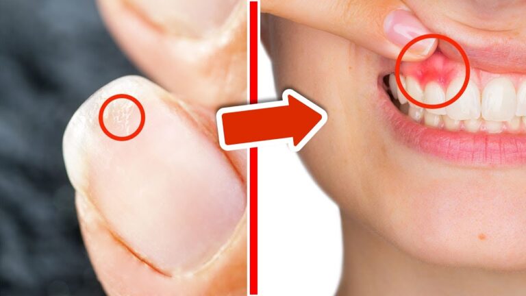 11 signes surprenants que votre corps vous envoie pour rester en bonne santé !